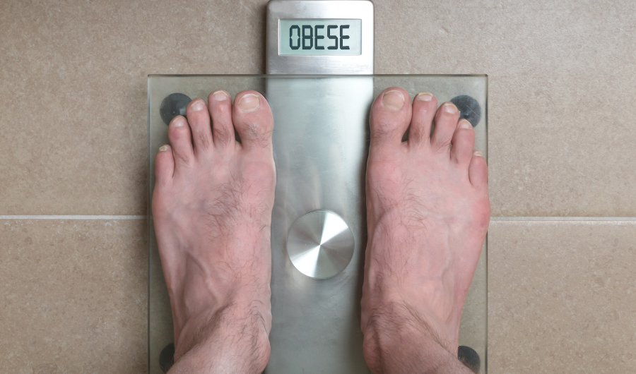 obesity and foot swelling relation